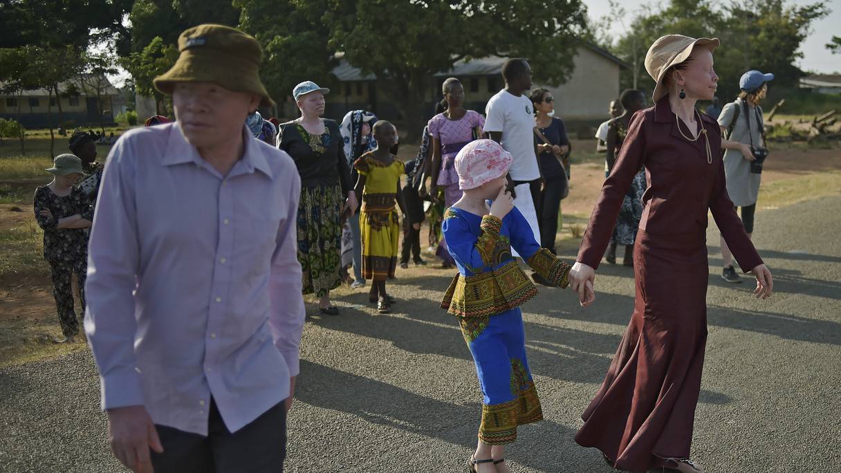 Albinos sur l'île d'Ukerewe lors de la journée internationale de sensibilisation à l'albinisme le 13 juin 2016. L'île d'Ukerewe abrite de nombreux albinos. Bon nombre des premiers albinos à vivre sur l'île y ont été emmenés et abandonnés par leurs familles lorsqu'ils étaient enfants ou ont fui la violence à laquelle ils avaient été confrontés sur le continent.