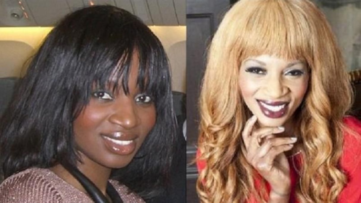 La dépigmentation au Sénégal