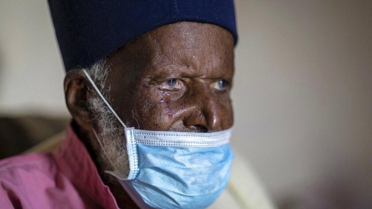 Le centenaire a reçu de l’oxygène et de la dexaméthasone, un stéroïde bon marché et largement disponible qui, selon des chercheurs anglais, a permis de réduire d’un tiers le nombre de décès chez les patients hospitalisés gravement malades.